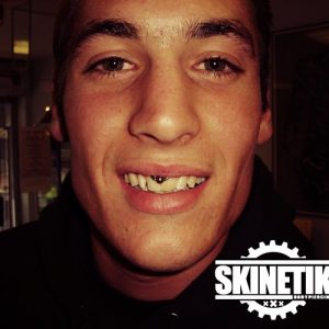 piercing_skinetik_smiley_02