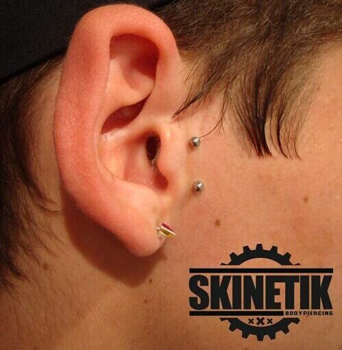 Skinetik