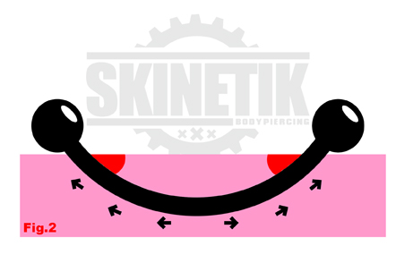 skinetik_piercing_surface_02