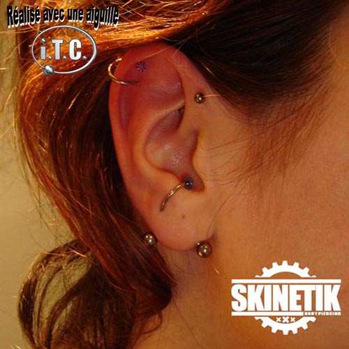 Skinetik