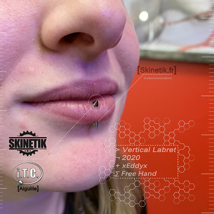 Skinetik