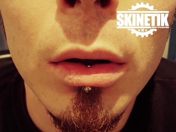 Skinetik