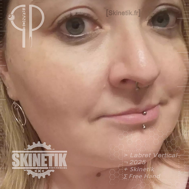 Skinetik