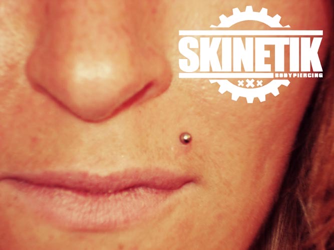 Skinetik