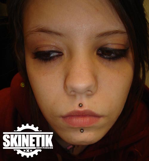 Skinetik