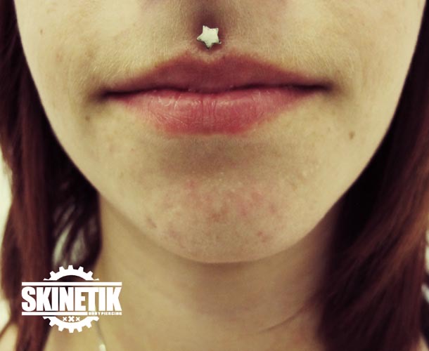 Skinetik