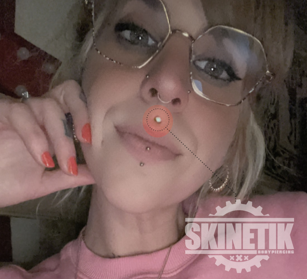 Skinetik