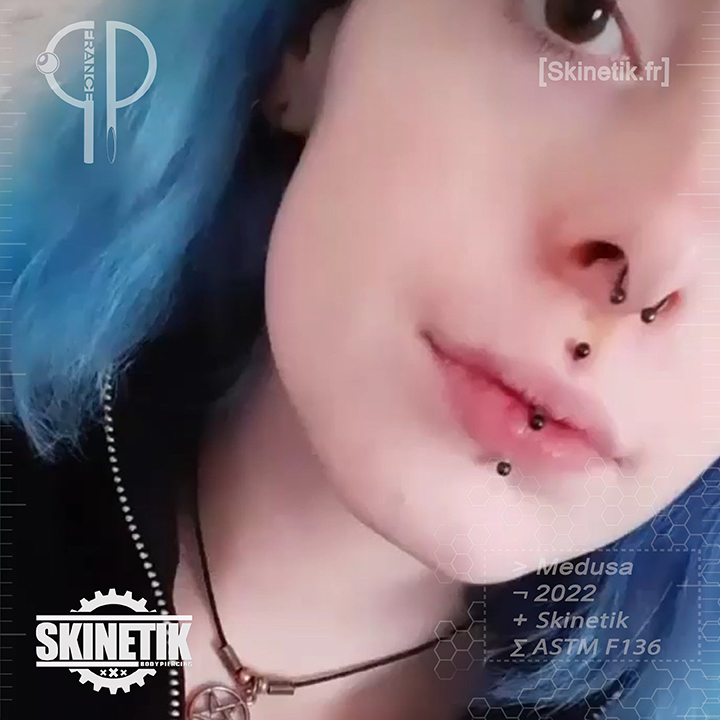 Skinetik