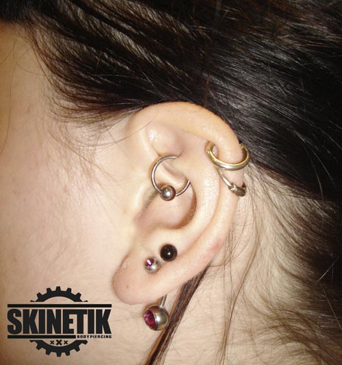 Skinetik