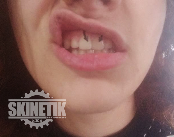 Skinetik