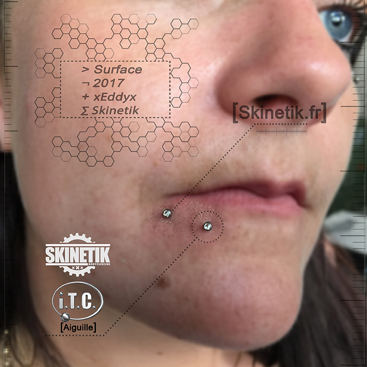 Skinetik
