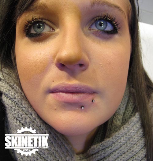 Skinetik