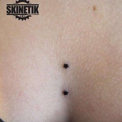Skinetik