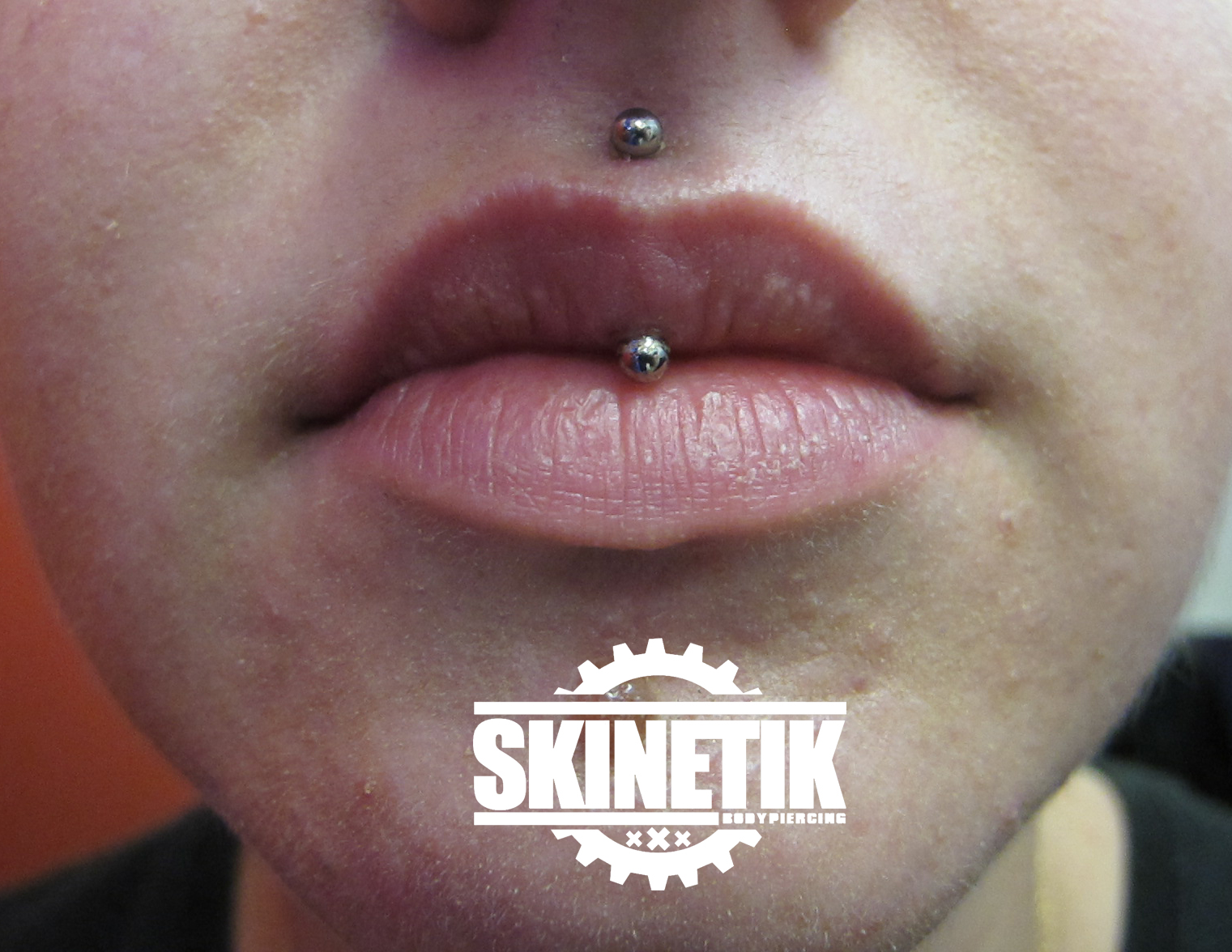 Skinetik