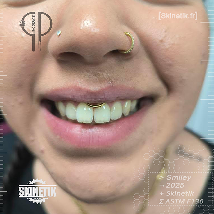 skinetik_piercing_smiley_09
