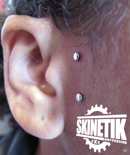 Skinetik