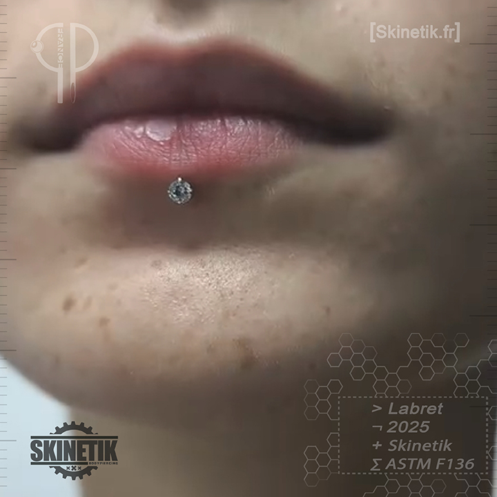 Skinetik