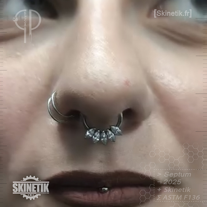 Skinetik